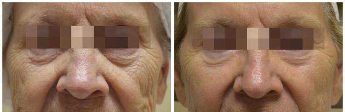 Jim Brantner M.D. Plastic and Reconstructive Surgery Cover Image