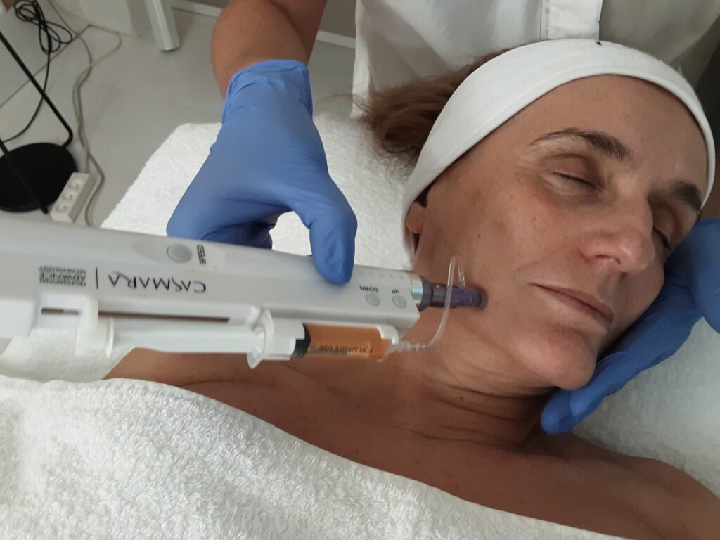 Clínica de Tratamiento Facial Alicante | Mejor Tratamiento Facial Dermapen y de Labios