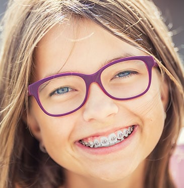 Clear Braces Santa Clarita | Damon Braces Valencia| 91355 | Canyon Country | Ceramic & Lingual Braces