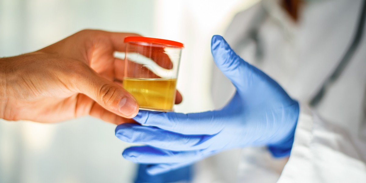 An Overview of Drug Screening Methods: Understanding Urine, Hair, Saliva, and Sweat Testing