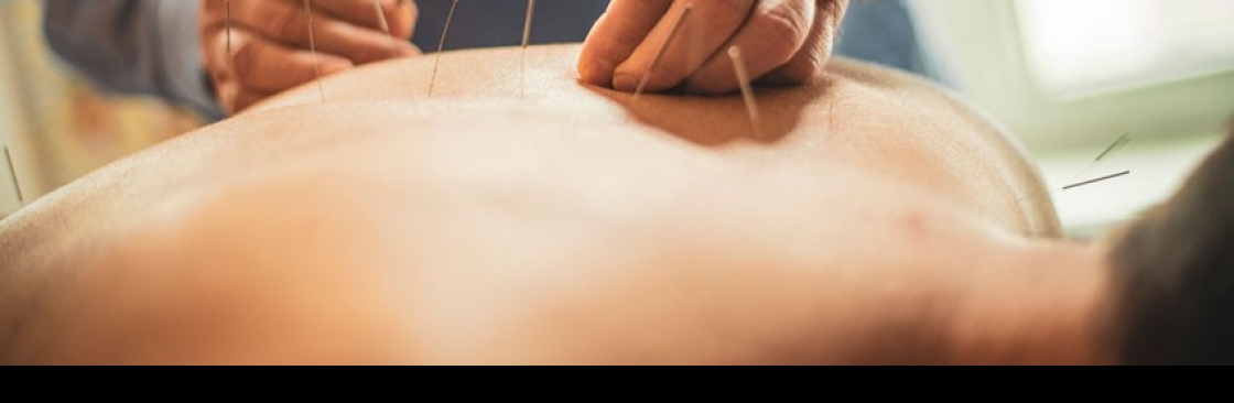 Cho Acupunture Cover Image