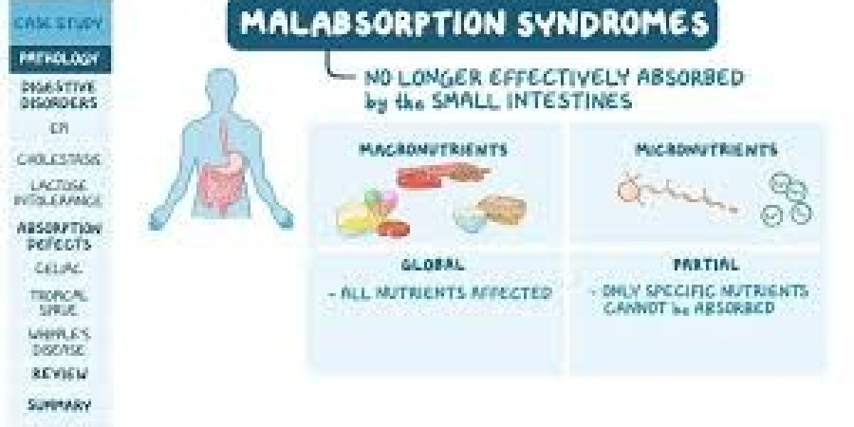 Understanding Malabsorption Syndromes: Causes, Symptoms, and Management