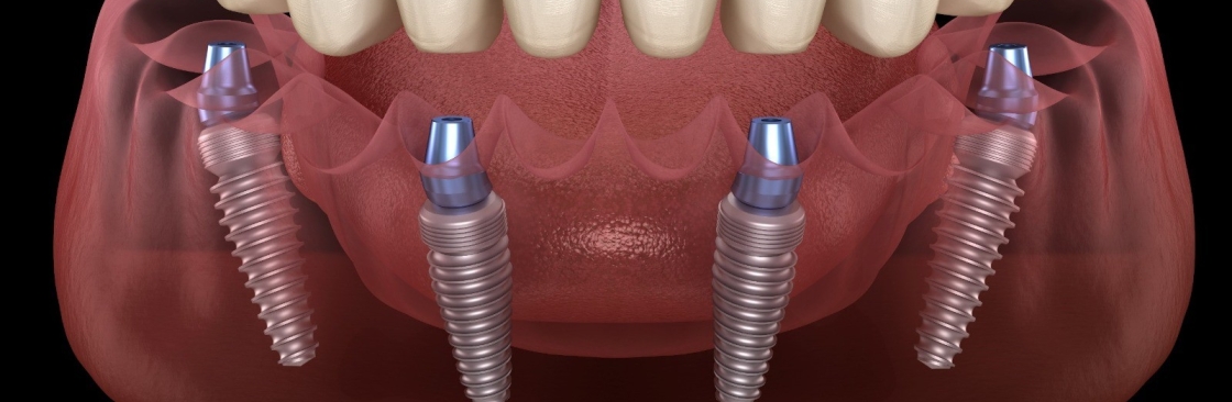 Teethsavers Dental Clinic Cover Image