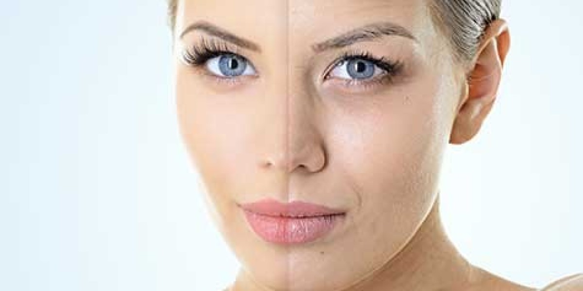 The Ultimate Guide to Skin Rejuvenation: Treatments, Benefits, and Expert Tips!