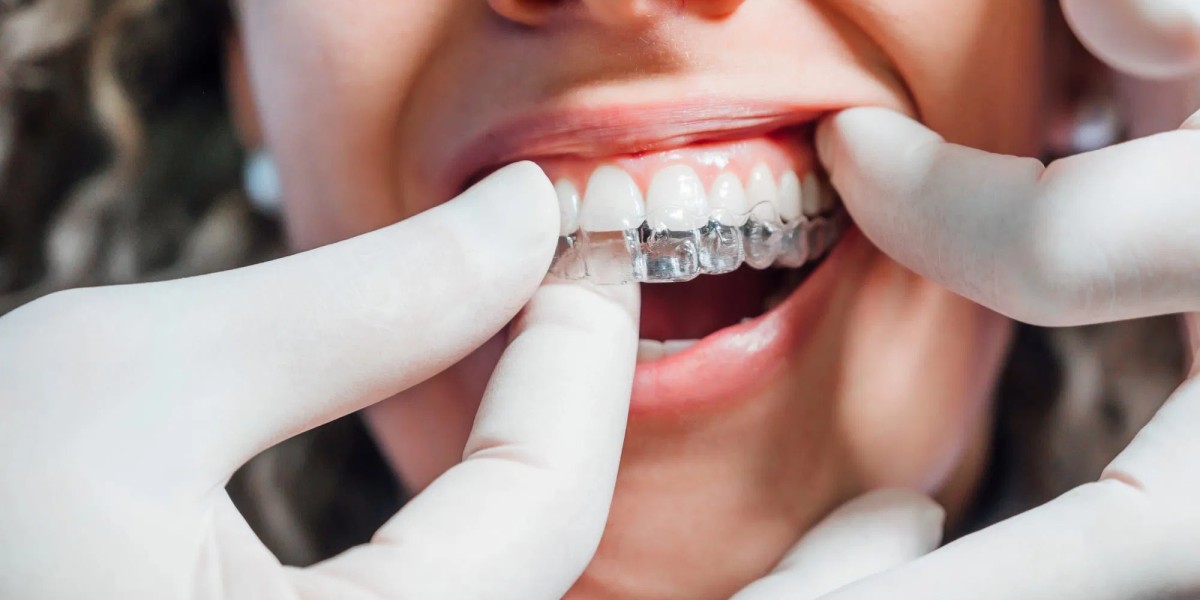 The Benefits of Choosing Invisalign in Dubai Over Traditional Braces