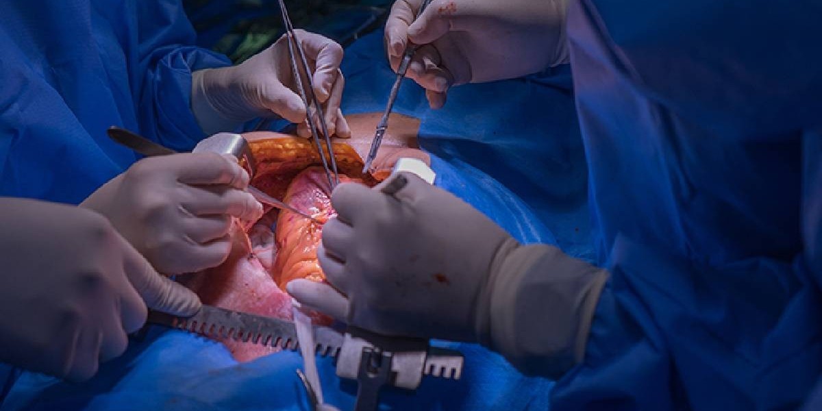Conditions in Which Open Heart Surgery Is Required