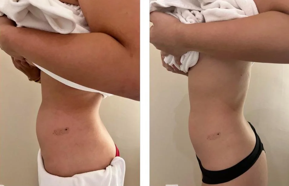 Transform Your Body with EmShape Body Sculpture at U Aesthetics Medispa — The Effortless Way to Burn Fat, Tone Muscles, and Lift Problem Areas! | by U Aesthetics Medispa | Apr, 2025 | Medium