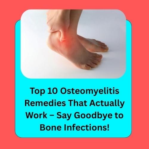 Top 10 Osteomyelitis Remedies That Actually Work – SayG...