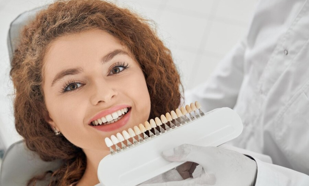 What Are Porcelain Veneers and How Can They Improve Your Smile?