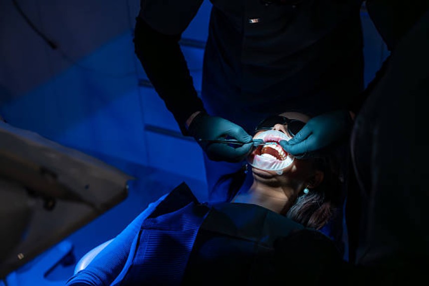 Blogs - Bang Box online - Night Guards: Why a Custom-Fit is Worth the Investment