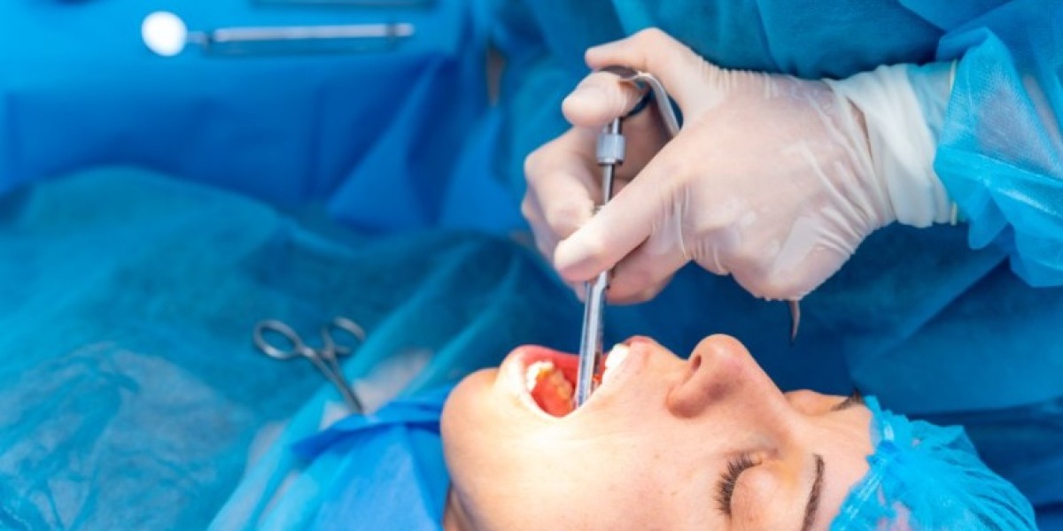 Tooth Extraction Services in Mississauga: A Complete Guide by Afflux Dentistry