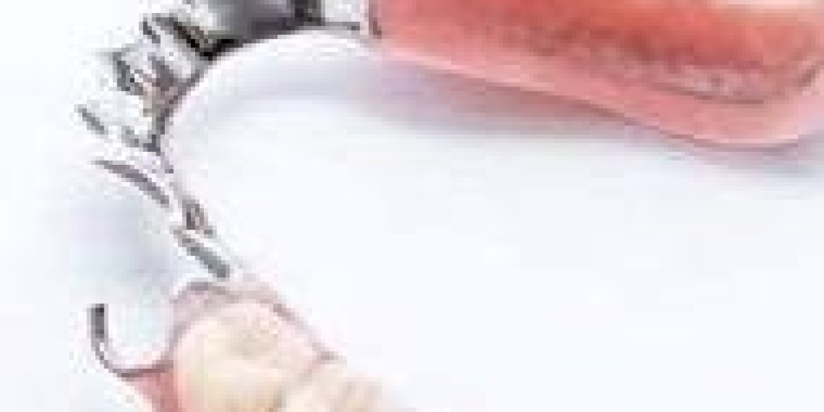 Dentist Recommended Tips for Using 牙托