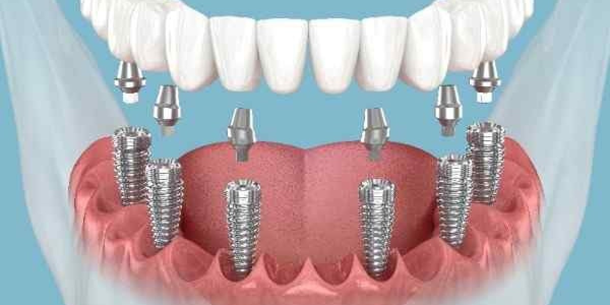 Getting the Smile You Want with Trusted Support in Doverv