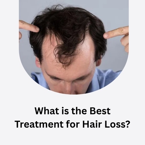 What is the Best Treatment for Hair Loss? A Complete Guide to Regrowing Your Hair Naturally and Effectively - Natural Health News