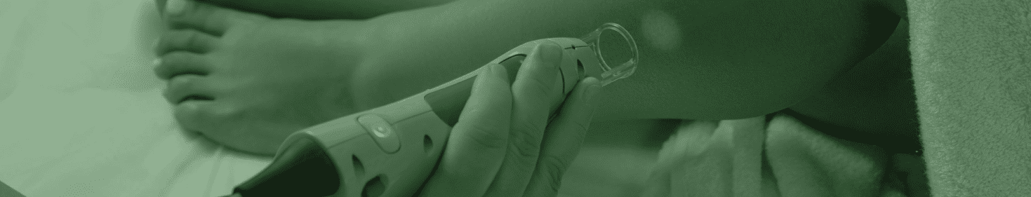 Laser Hair Removal in East Brunswick, NJ | Anara Medspa