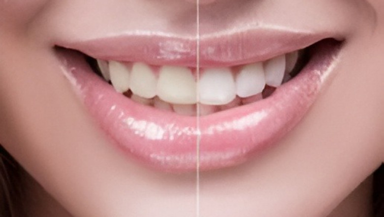 Your Trusted Dentist in Northridge for Complete Family and Cosmetic Care | Times Square Reporter