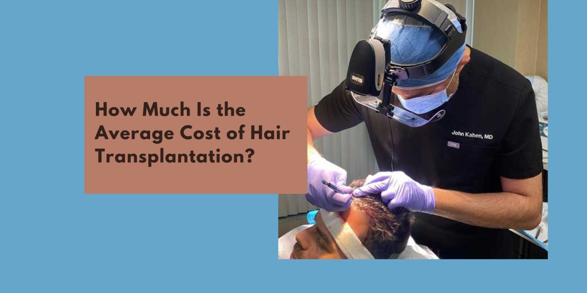 How Much Is the Average Cost of Hair Transplantation?