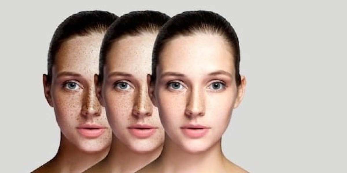 Redness, Rashes, or Pigmentation? When to See a Dermatologist