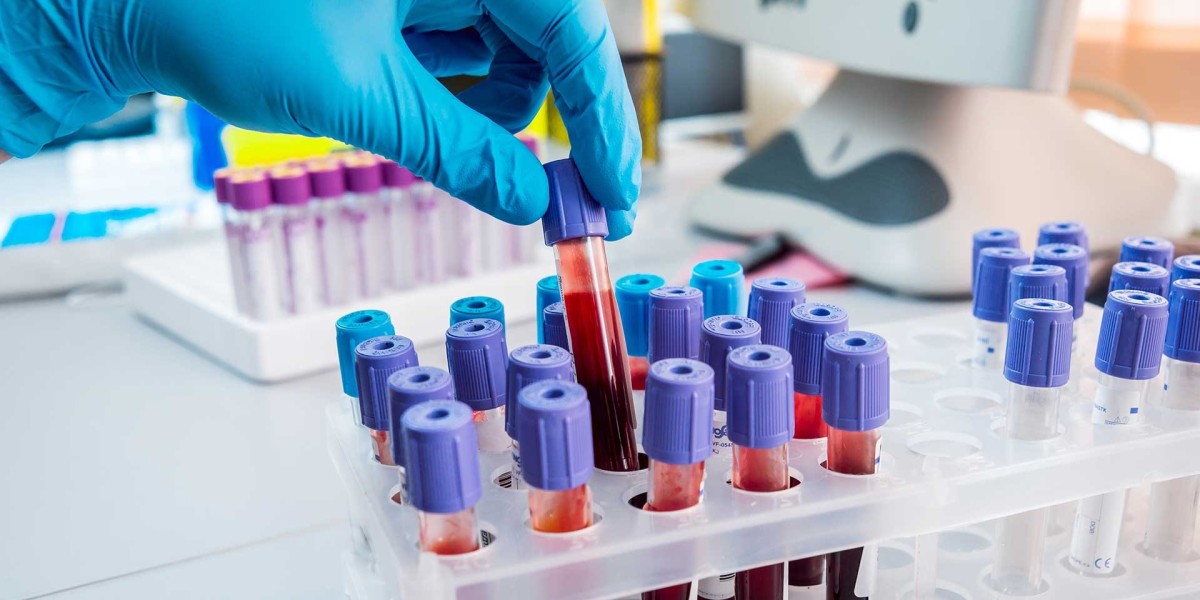 Advanced Cancer Treatment Lagos: Expert Care at Genesis Specialist Hospital