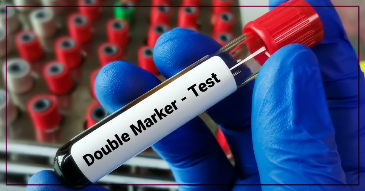 Viability Scan in Chandigarh | The Garbh Clinic