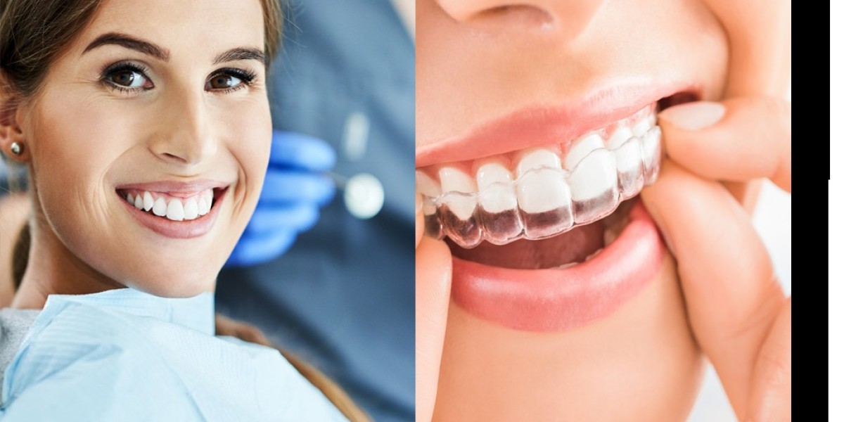 Top Emergency Dentist in Five Dock – Smile Circle to the Rescue!