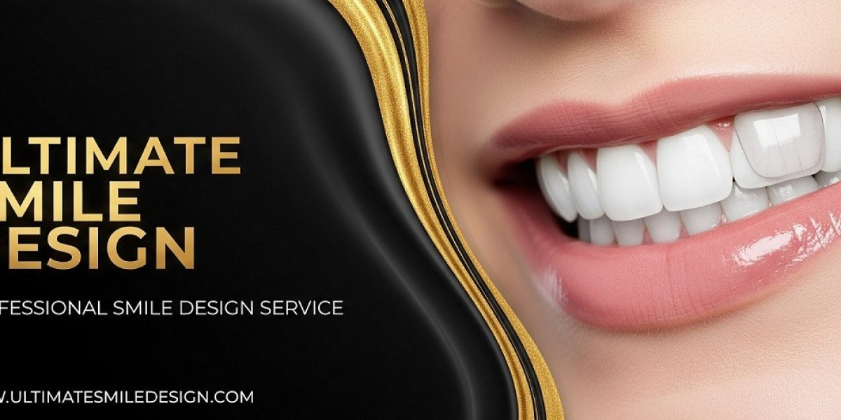 Smile Design Crafting Your Perfect, Natural Smile
