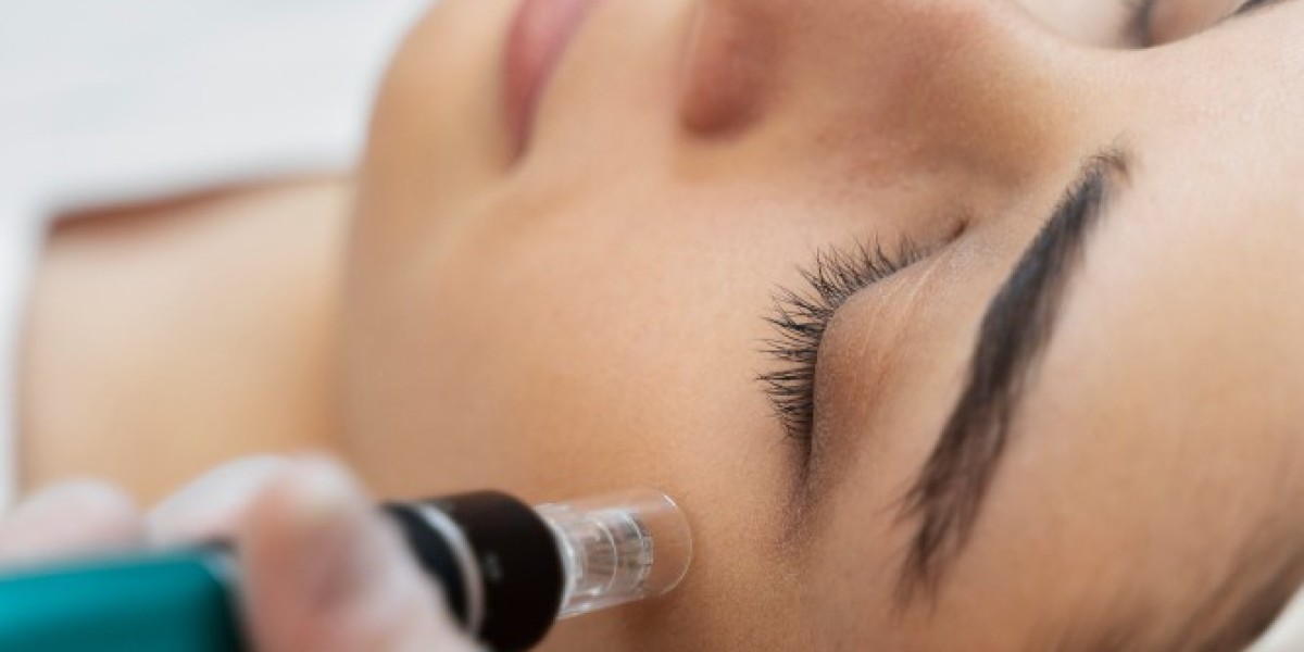 The Role of Microneedling in Modern Skincare