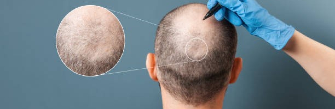 Want Hair Cover Image