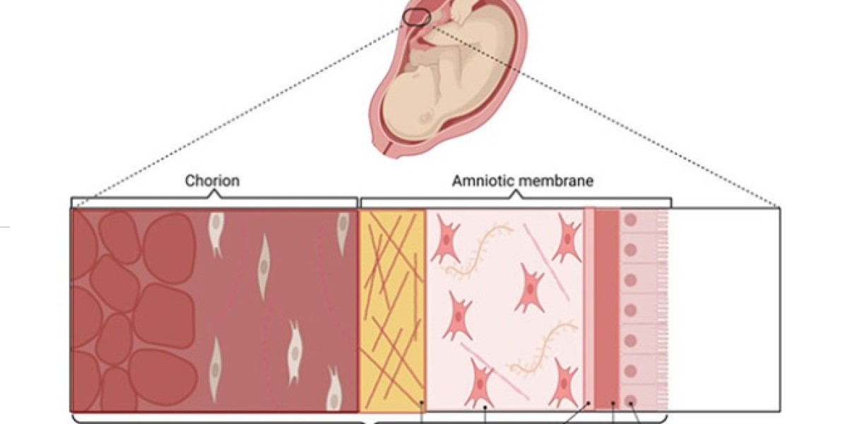 Revolutionizing Healing with Amniotic Allografts