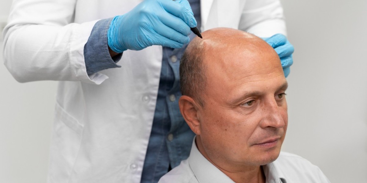 Hair transplant cost Atlanta ga