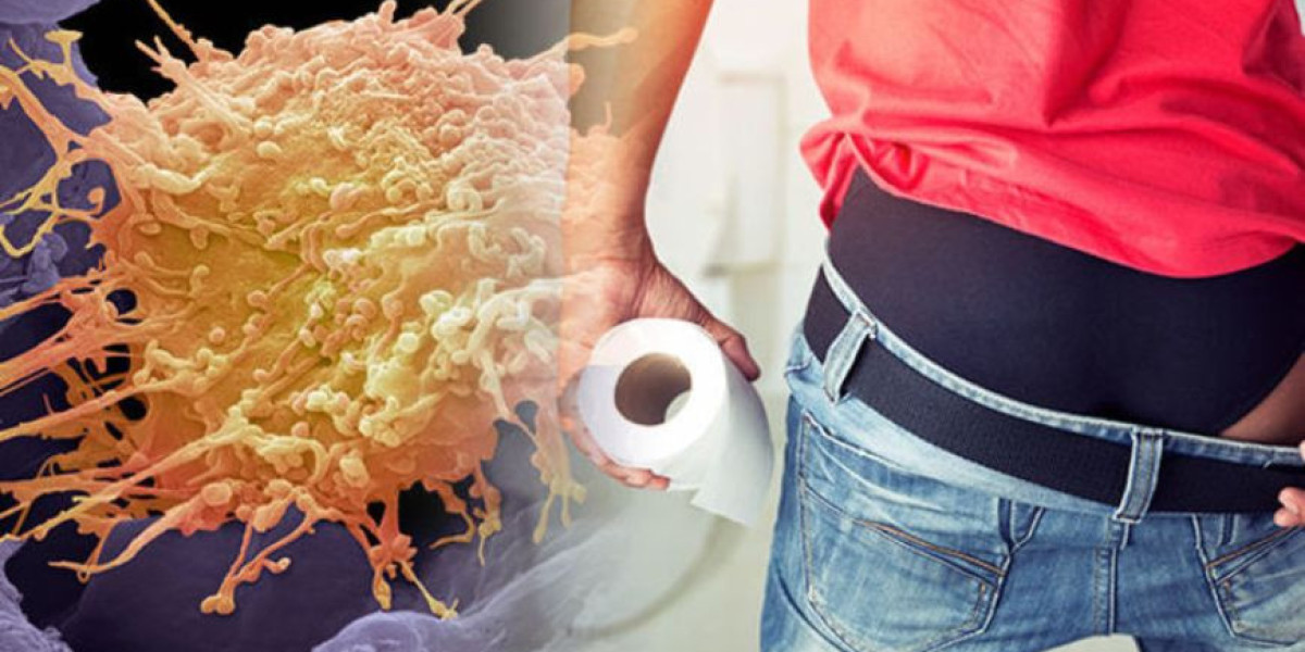 What’s Behind the Shifts in Anal Cancer Epidemiology?