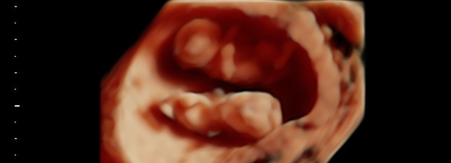 4d scan at 30 weeks Cover Image