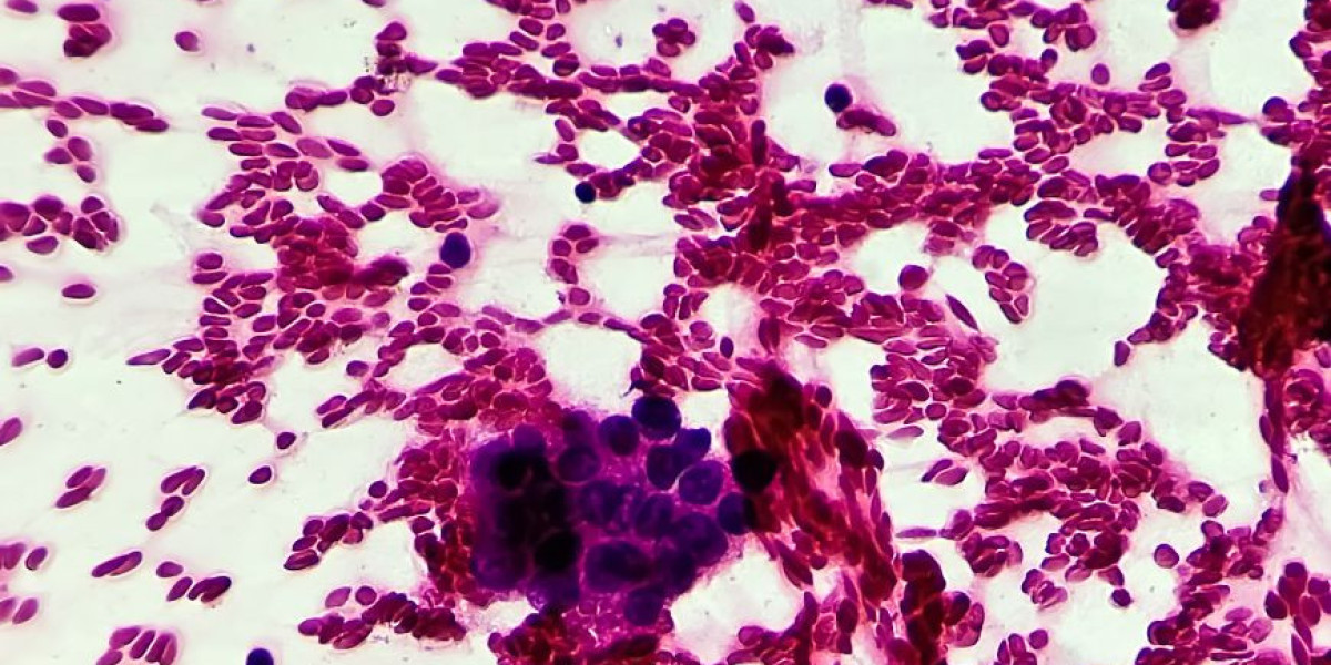 How Can Hepatocellular Carcinoma Epidemiology Forecast Improve Healthcare?