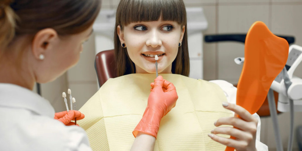 Common Questions About Dental Veneers in Fairfax, VA Answered