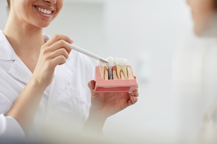 Tooth Whitening Richmond: Brighten Your Smile with Cosmetic Dentistry