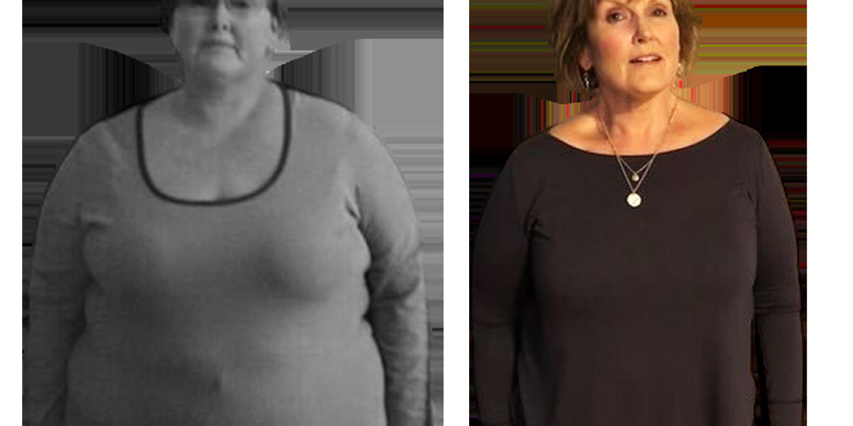 Therapy for Weight Loss: Exploring Innovative Approaches