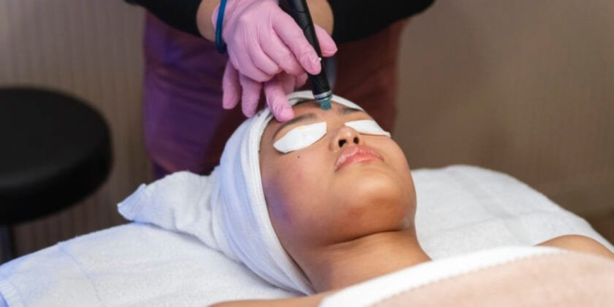 Hydra Facial Oakville - Uptown Med Spa Oakville