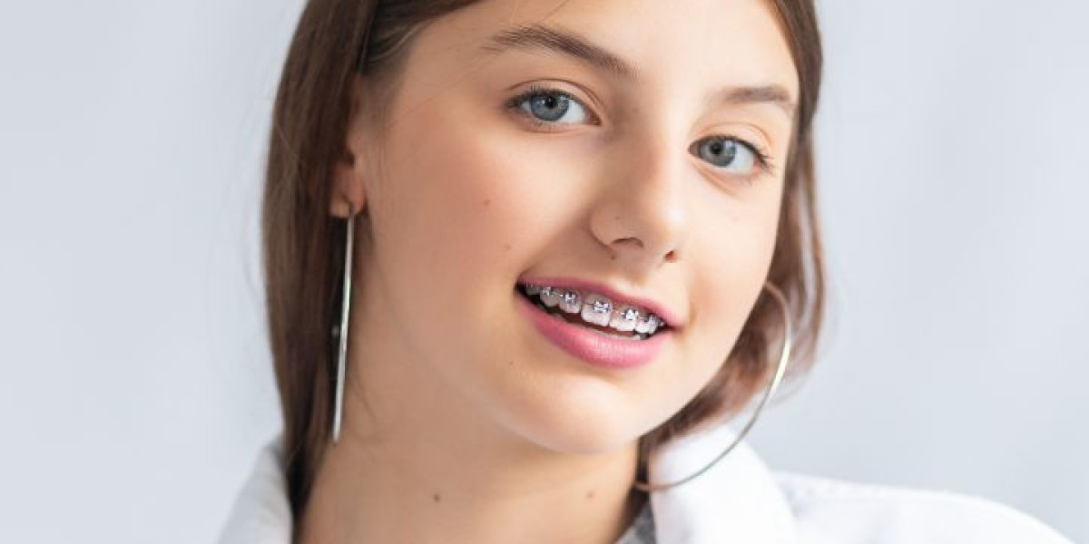 How Much Are Braces? Comparing Traditional and Modern Orthodontic Options