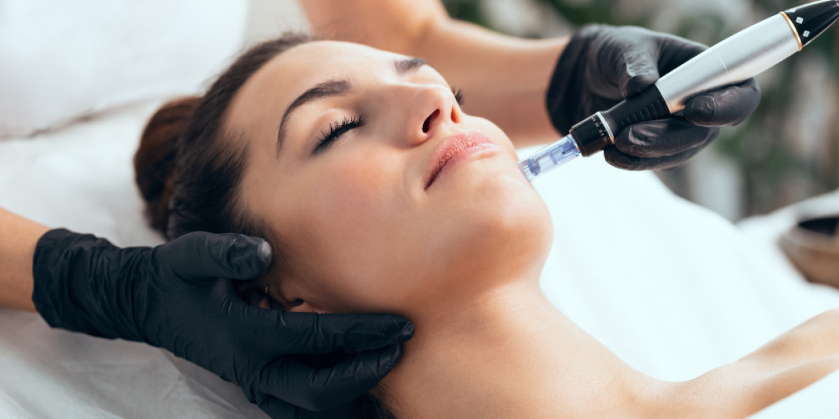 Microneedling Treatment - Ultimate Skin Tightening Guide