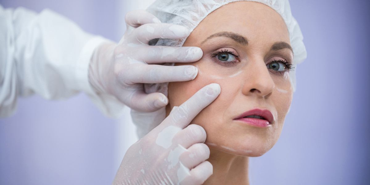 Under-Eye Rejuvenation in London: Why Polynucleotides Are the Secret to Fresh Eyes