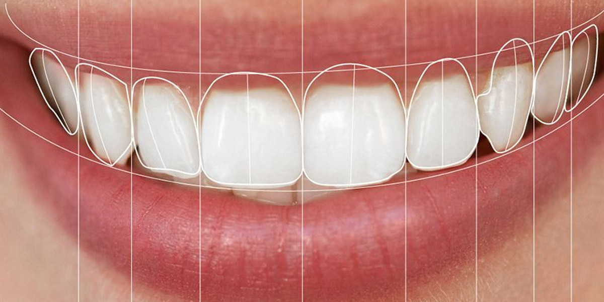 Why Digital Smile Design is the Future of Patient-Centered Dental Restorations