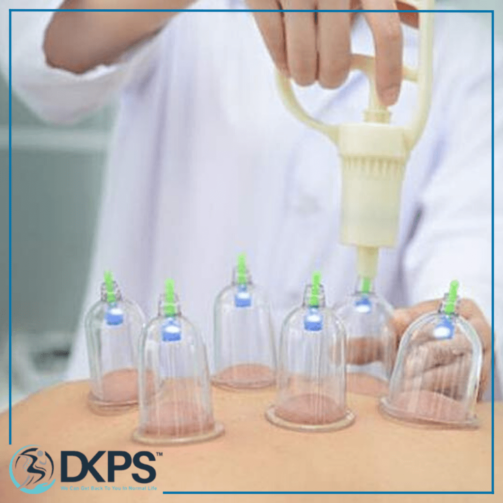 Best Cupping Therapy Affordable Price in Delhi – DKPS