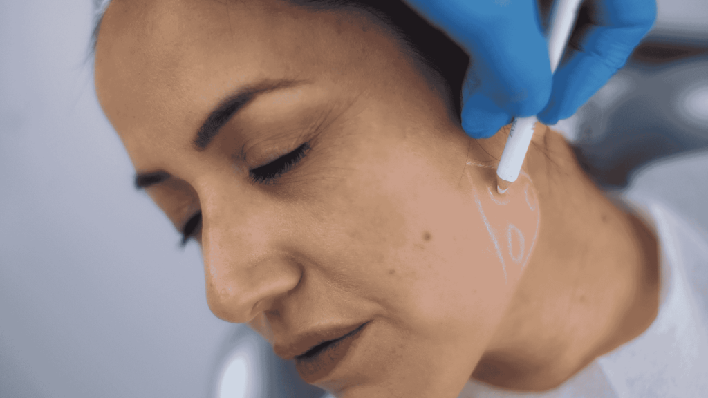 Best Jawline Filler in Walnut Creek | Beau Visage Aesthetics