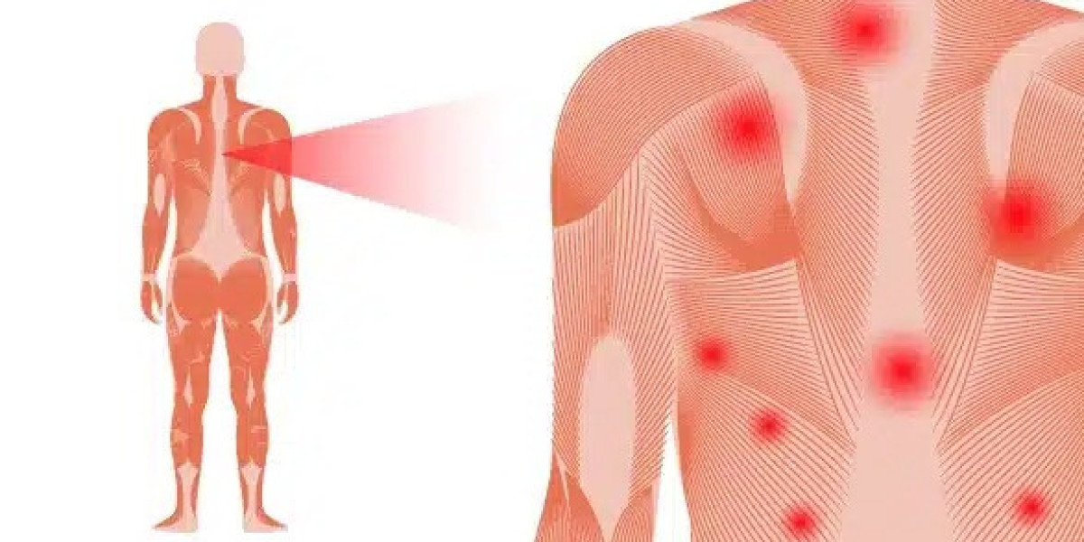 Early Warning Signs of Fibromyalgia Syndrome You Shouldn’t Ignore