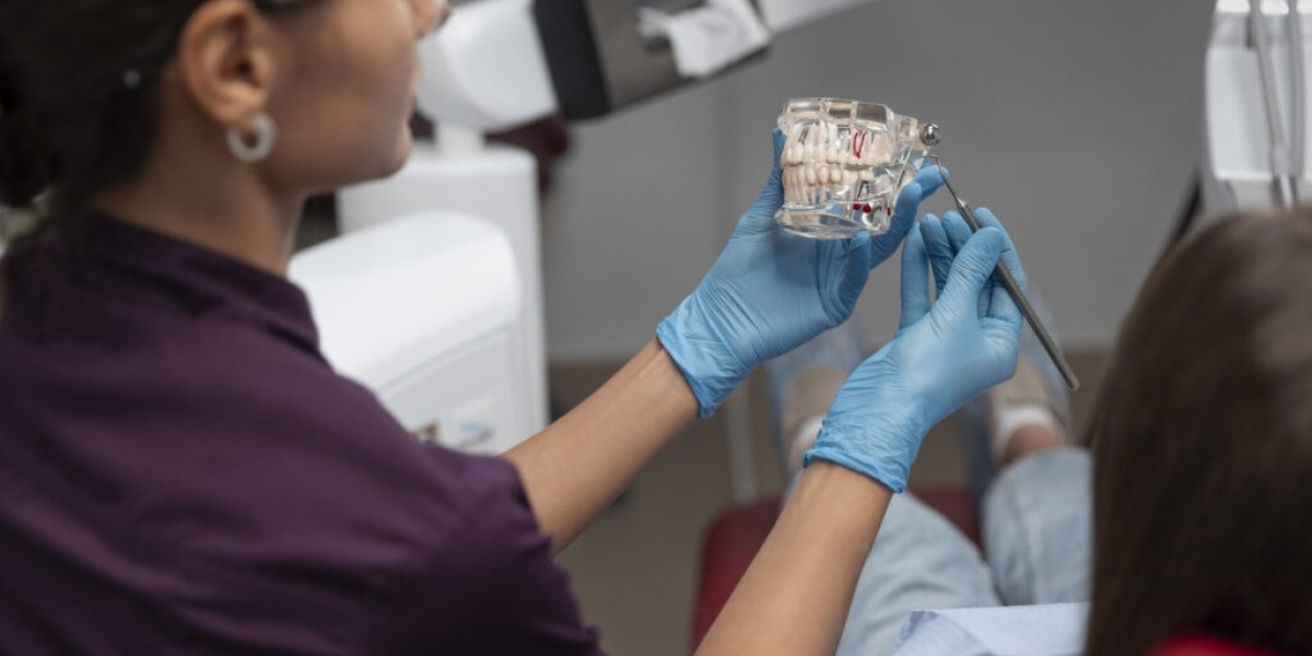 Full Mouth Dental Implants: Expert Care for a Complete Smile Restoration