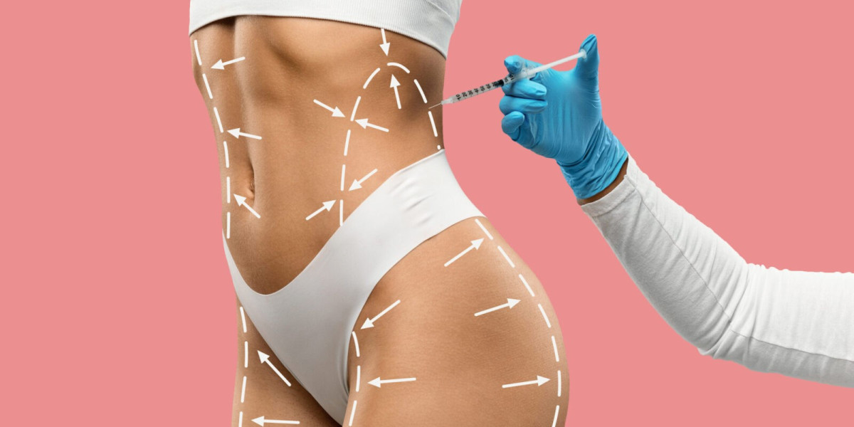 Everything You Need to Know About Body Fillers