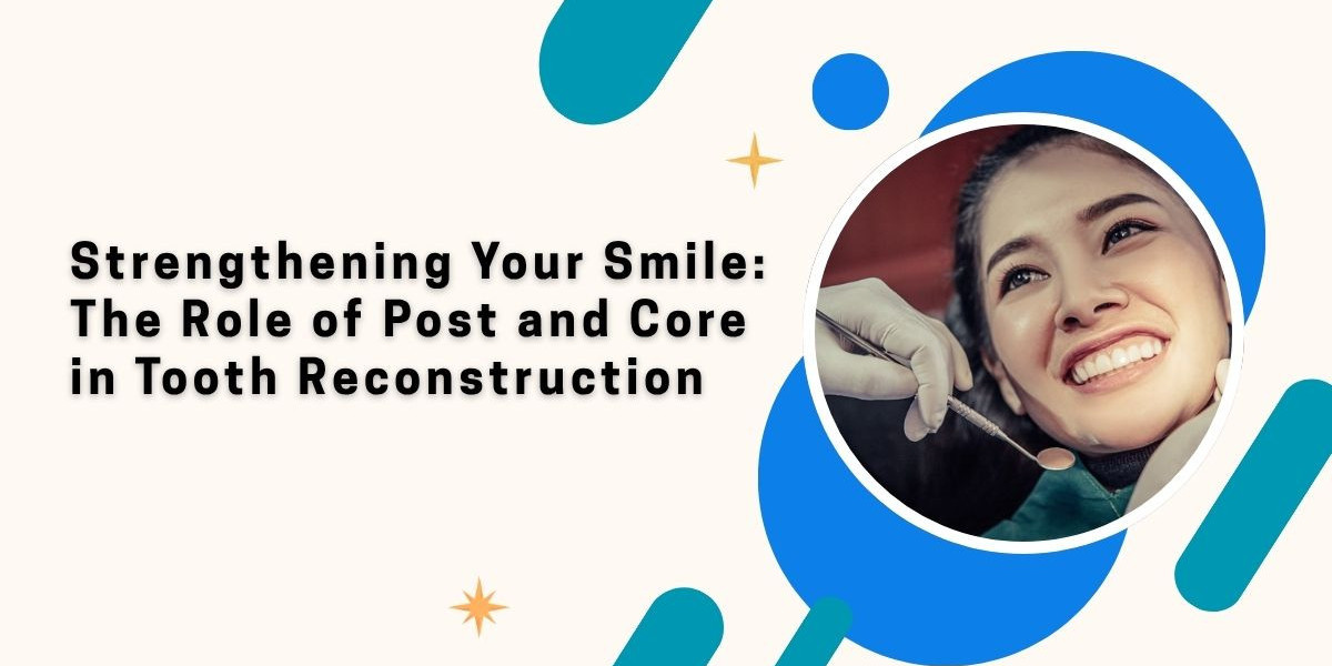Strengthening Your Smile The Role of Post and Core in Tooth Reconstruction