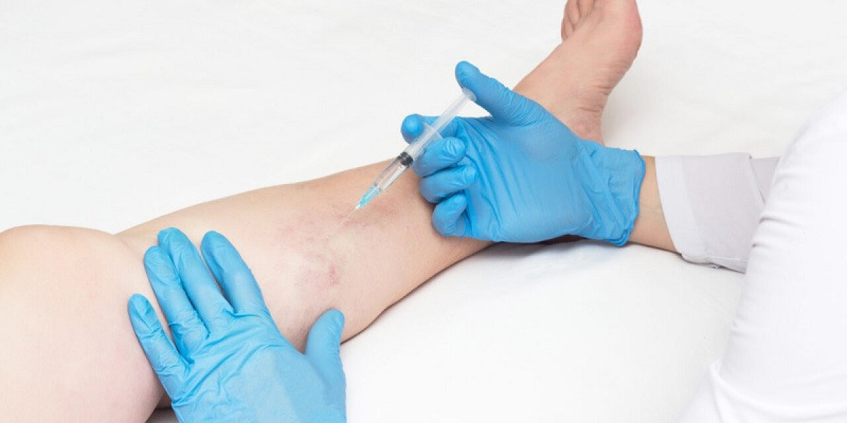 What Procedures Are Offered at a Professional Vein Treatment Clinic?