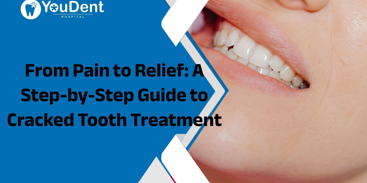 From Pain to Relief: A Step-by-Step Guide to Cracked Tooth Treatment