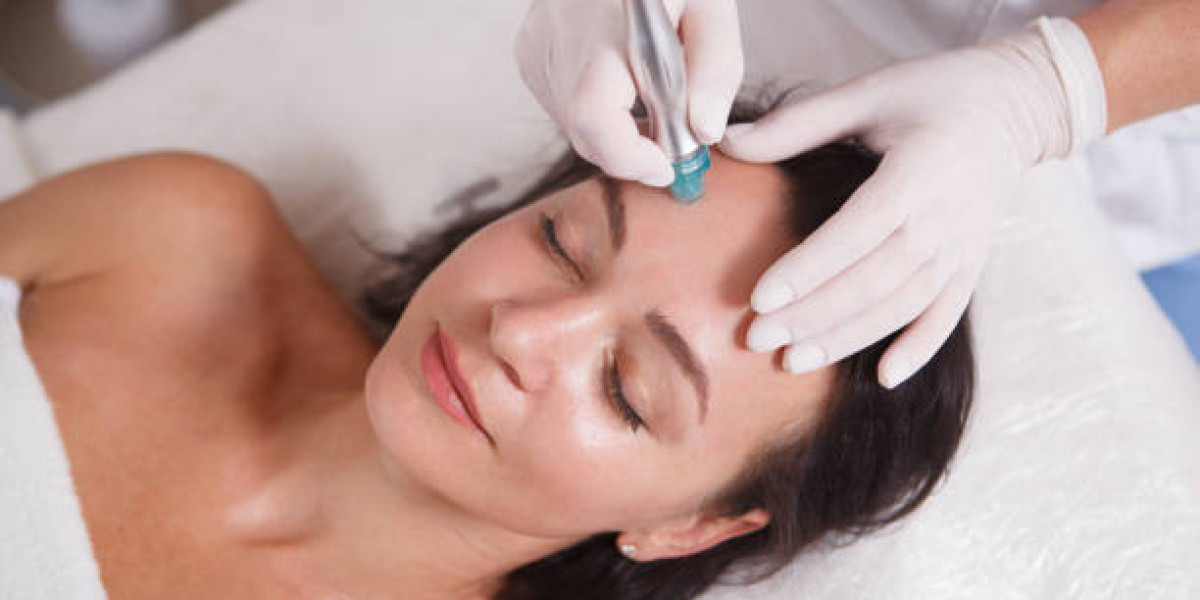 ما هو أفضل وقت لعمل الهيدرافيشل في الرياض؟